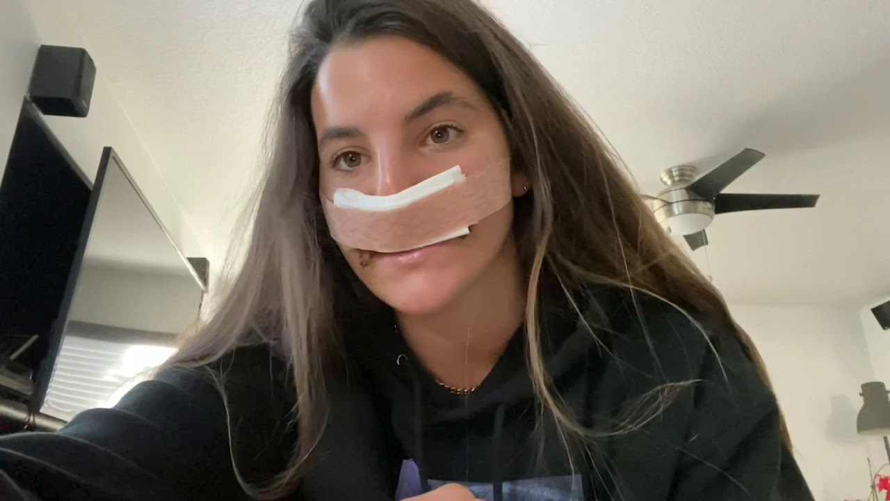 Pro skater and model Brooke Khoury - Latest update after pitbull attack - 2