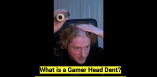 What is a Gamer Head Dent Instagram Viral Video Explained
